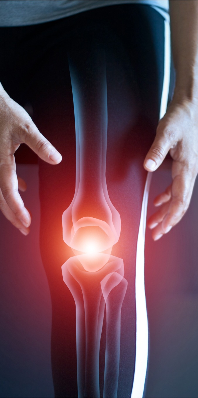Joint Pain